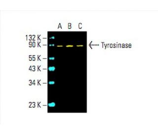 Tyrosinase Antibody (T311) - Western Blotting - Image 394812 