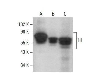 Tyrosine Hydrolase Antibody (A-1) - Western Blotting - Image 352021