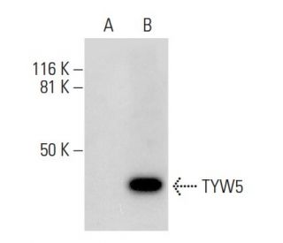 TYW5 Antibody (F-1) - Western Blotting - Image 288941 