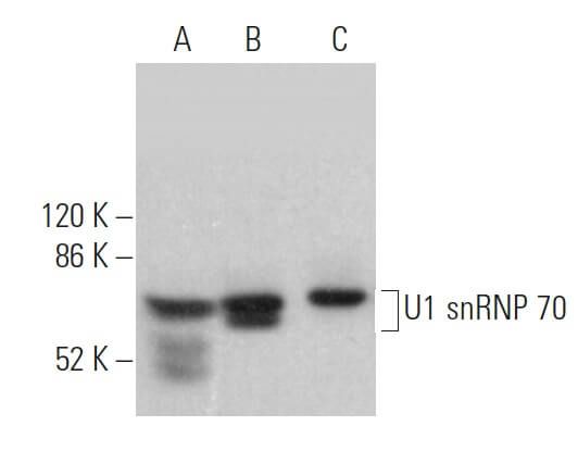 Snp 607 U1 snRNP 70抗体 (C-3) | SCBT - Santa Cruz Biotechnology