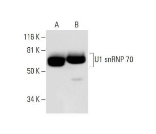U1 snRNP 70 Antibody (E-4) - Western Blotting - Image 291888 