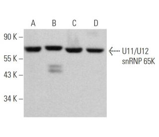 U11/U12 snRNP 65K Antibody (H-5) - Western Blotting - Image 370063 