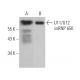 U11/U12 snRNP 65K Antibody (H-5) - Western Blotting - Image 370077