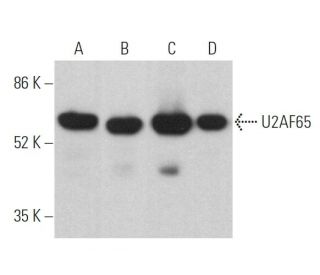 western blotting image from recommended U2AF65 (MC3) monoclonal antibody replacement. Image 360292