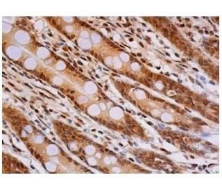 immunohistochemistry image from recommended Ubiquitin (P4D1) monoclonal antibody replacement. Image 356766