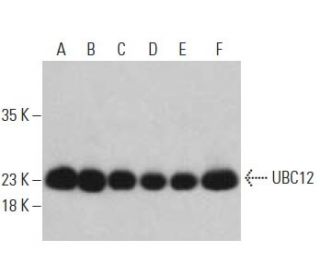 UBC12 Antibody (D-4) - Western Blotting - Image 396096
