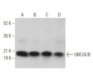 UBE2A/B Antibody (G-9) - Western Blotting - Image 371633 
