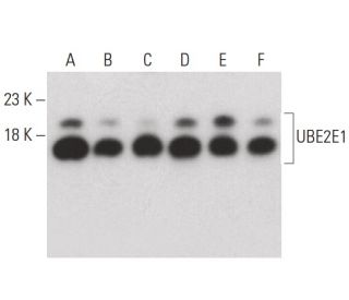 UBE2E1 Antibody (42) - Western Blotting - Image 399636 