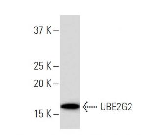 UBE2G2 Antibody (2E6) - Western Blotting - Image 33984 