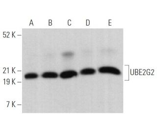 UBE2G2 Antibody (D-4) - Western Blotting - Image 364734 