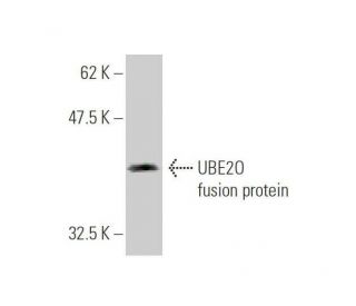 UBE2O Antibody (2C10) - Western Blotting - Image 350257