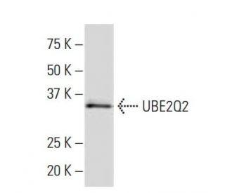 UBE2Q2 Antibody (R-16) - Western Blotting - Image 33996 