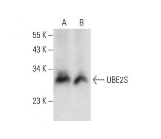 UBE2S Antibody (F-10) - Western Blotting - Image 303802