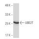 UBE2T Antibody (4E5) - Western Blotting - Image 33994
