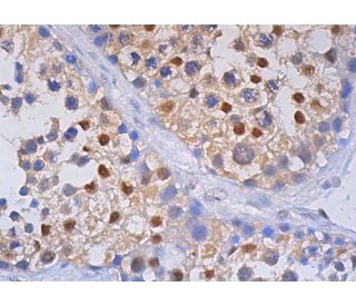 ★★★まい。★★★ Ubiquitin抗体(A-5) | SCBT - Santa Cruz Biotechnology