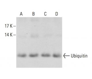 mayu様おまとめ購入ページ Ubiquitin Antibody (A-5) | SCBT - Santa Cruz Biotechnology