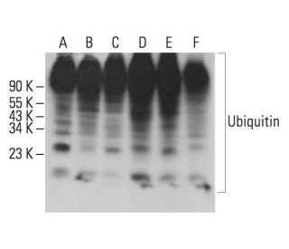 シュタインボルグpsa10 Ubiquitin Antibody (A-5) | SCBT - Santa Cruz Biotechnology