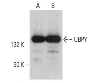 UBPY Antibody (E-1): sc-376130