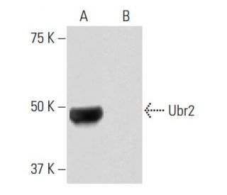 Ubr2 Antibody (8H10) - Western Blotting - Image 65087
