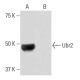 Ubr2 Antibody (8H10) - Western Blotting - Image 65087