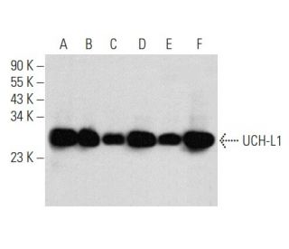 UCH-L1 Antibody (31A3) - Western Blotting - Image 356952 