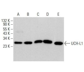 UCH-L1 Antibody (13C4) - Western Blotting - Image 375598