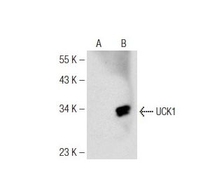 UCK1 Antibody (E-9) - Western Blotting - Image 147246Each CRISPR/Cas9 Knockout (KO) Plasmid product consists of a pool of 3 plasmids designed to ensure identification and cleavage of a specific gene for maximum knockout efficiency. Each plasmid encodes a unique 20 nt sequence derived from the GeCKO (v2) library.