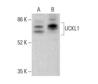 UCKL1 Antibody (B-11) - Western Blotting - Image 377014 