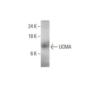 UCMA Antibody (H-2) - Western Blotting - Image 348630The Double Nickase Plasmid features a U6 promoter for sgRNA expression, a 20 nt targeting sequence, and a gRNA scaffold to guide Cas9n. It includes a CBh promoter for Cas9n (D10A) and puromycin resistance, GFP for transfection verification, and nuclear localization signals (NLS). The 2A peptide allows co-expression of Cas9n and Puro from a single promoter, enabling precise genome editing with reduced off-target effects. 