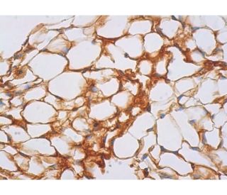 UCP1 Antibody (A-6) - Immunohistochemistry - Image 387726 