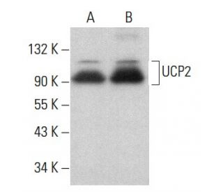 UCP2 Antibody (G-6) - Western Blotting - Image 379498 