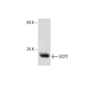 western blotting image from recommended UCP2 (G-6) monoclonal antibody replacement. Image 286861