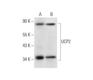 UCP2 Antibody (G-6) - Western Blotting - Image 326512The Double Nickase Plasmid features a U6 promoter for sgRNA expression, a 20 nt targeting sequence, and a gRNA scaffold to guide Cas9n. It includes a CBh promoter for Cas9n (D10A) and puromycin resistance, GFP for transfection verification, and nuclear localization signals (NLS). The 2A peptide allows co-expression of Cas9n and Puro from a single promoter, enabling precise genome editing with reduced off-target effects.