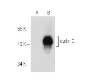 cyclin O Antibody (F-3) - Western Blotting - Image 154050SAM Transcription Activation: SAM system utilizing dCas9-VP64, MS2-P65-HSF1, and sgRNA for precise gene transcription activation. 