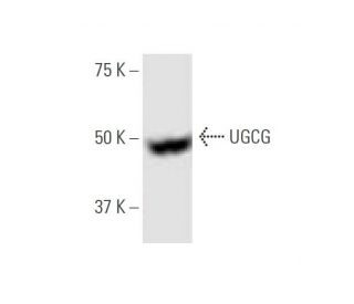 UGCG Antibody (1E5) - Western Blotting - Image 347584 