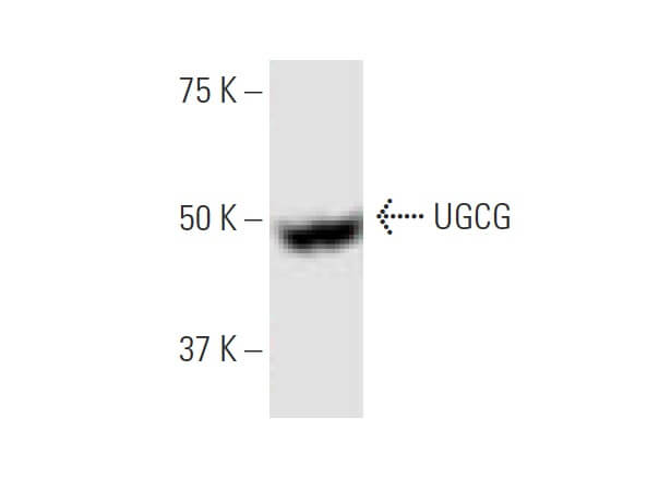 ugcg-antibody-1e5-western- ugcg-antibody-1e5-western-