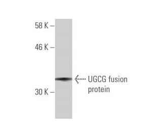 UGCG Antibody (1E5) - Western Blotting - Image 348872Each CRISPR/Cas9 Knockout (KO) Plasmid product consists of a pool of 3 plasmids designed to ensure identification and cleavage of a specific gene for maximum knockout efficiency. Each plasmid encodes a unique 20 nt sequence derived from the GeCKO (v2) library.