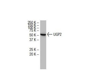UGP2 Antibody (34-B) - Western Blotting - Image 33862 