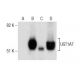 This polyclonal antibody has been discontinued. See our recommended <a href="ugt1a-antibody-b-4">UGT1A (B-4)</a> monoclonal antibody (sample data shown). western blotting image from recommended UGT1A (B-4) monoclonal antibody replacement. Image 282101