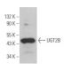 这种多克隆抗体已经停产。请参阅我们推荐的<a href="ugt2b-antibody-e-6">UGT2B (E-6)</a>单克隆抗体(显示样本数据)。 western blotting image from recommended UGT2B (E-6) monoclonal antibody replacement. Image 364027