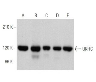 western blotting image from recommended UKHC (F-5) monoclonal antibody replacement. Image 359752
