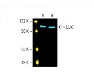 western blotting image from recommended ULK1 (F-4) monoclonal antibody replacement. Image 393435