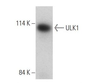 ULK1 Antibody (F-4) - Western Blotting - Image 399029