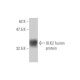 ULK2 Antibody (2A12) - Western Blotting - Image 349007