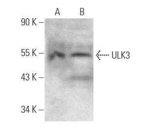 ULK3 Antibody (1404CT148.89.25) - Western Blotting - Image 374600SAM Transcription Activation: SAM system utilizing dCas9-VP64, MS2-P65-HSF1, and sgRNA for precise gene transcription activation.