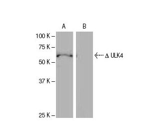 ULK4 Antibody (MH-49) - Western Blotting - Image 65088