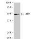 UMPS Antibody (3H6) - Western Blotting - Image 65089 