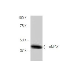 uMtCK Antibody (25-L) - Western Blotting - Image 53850