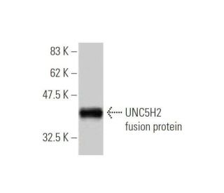 UNC5H2 Antibody (1A9) - Western Blotting - Image 350354