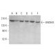 UNC5H3 Antibody (F-4) - Western Blotting - Image 377457